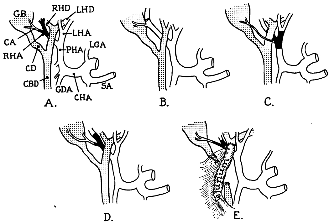 FIG. I