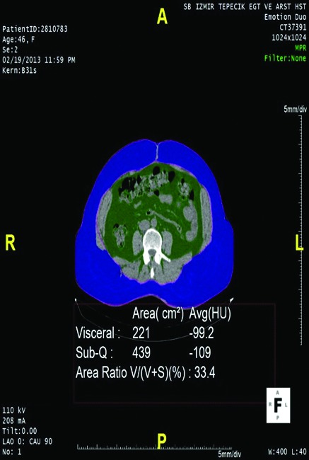 Fig. 2.