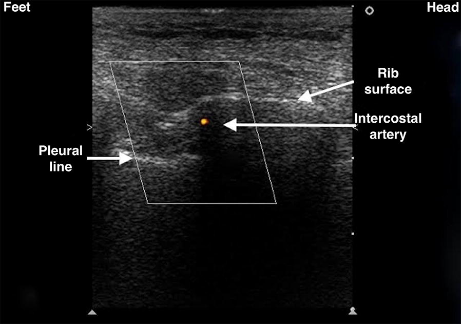 Fig. 2