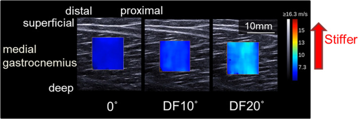 Figure 4