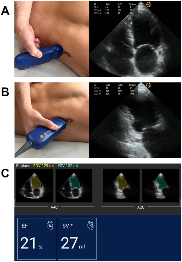 Fig. 4