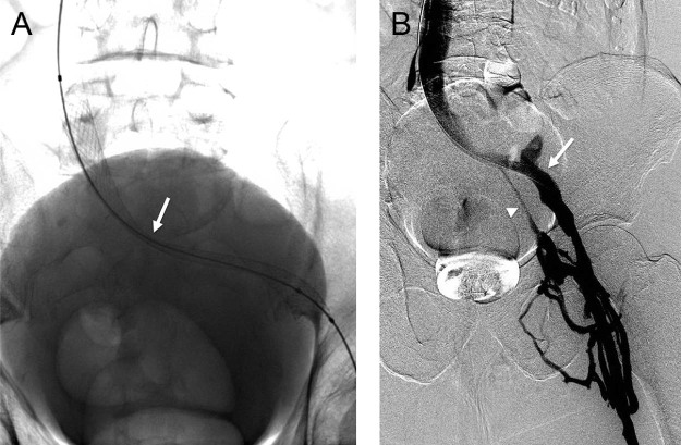 Fig. 2