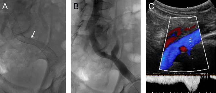 Fig. 4