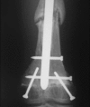 Fig. 3