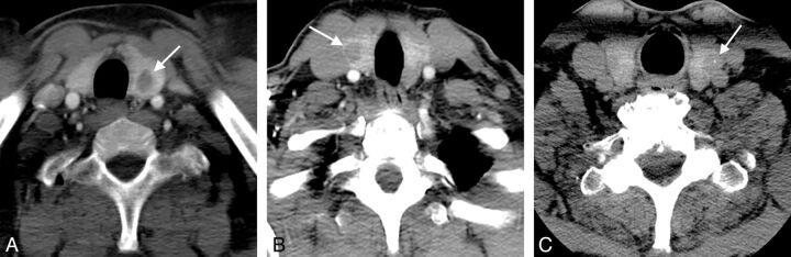 Fig 3.