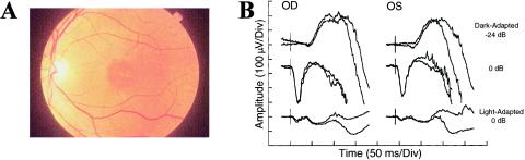 Figure  2