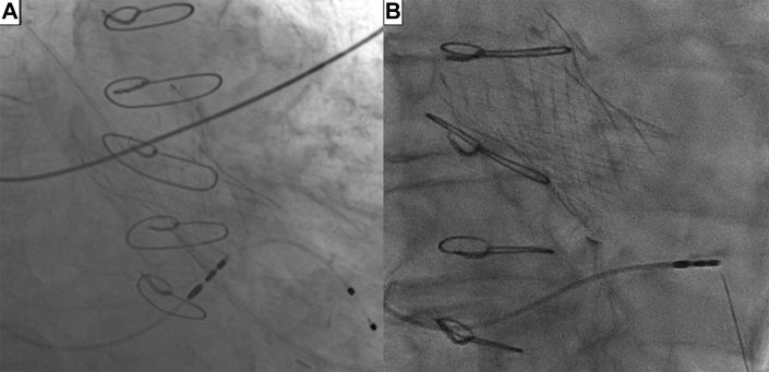 Figure 3