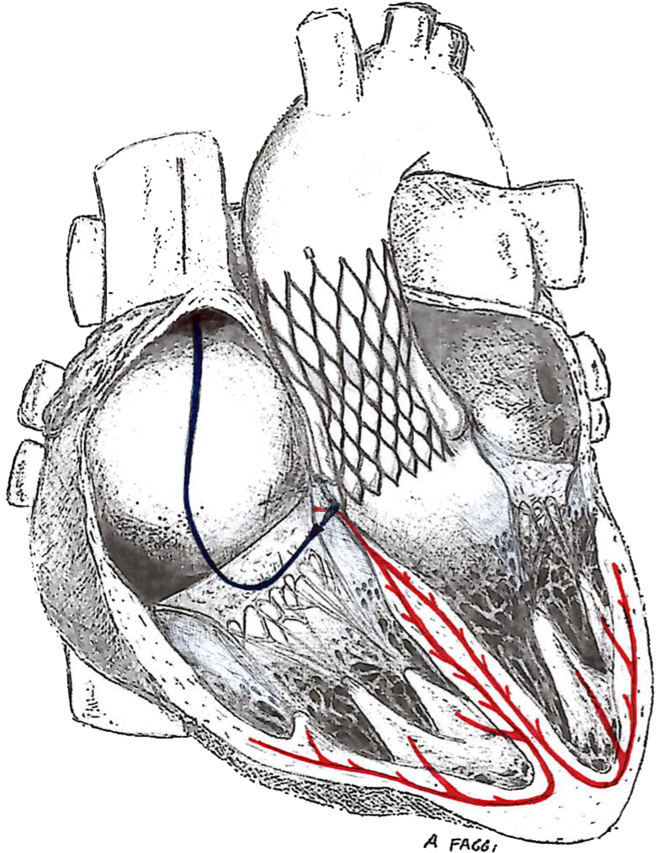 Figure 4