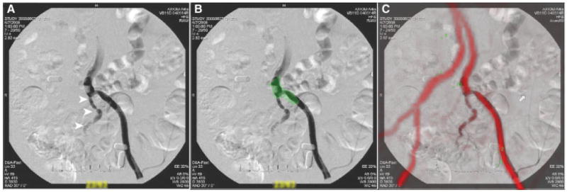 Fig. 4