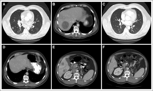 Fig 2.