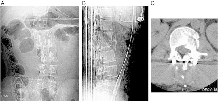 Fig 2