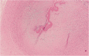 Fig. 13