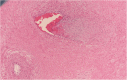 Fig. 12
