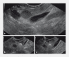 Fig. 1
