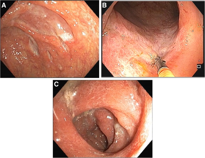 Fig. 1