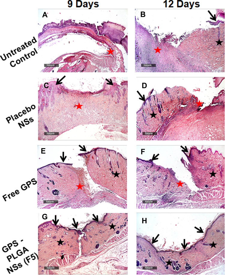 Figure 13