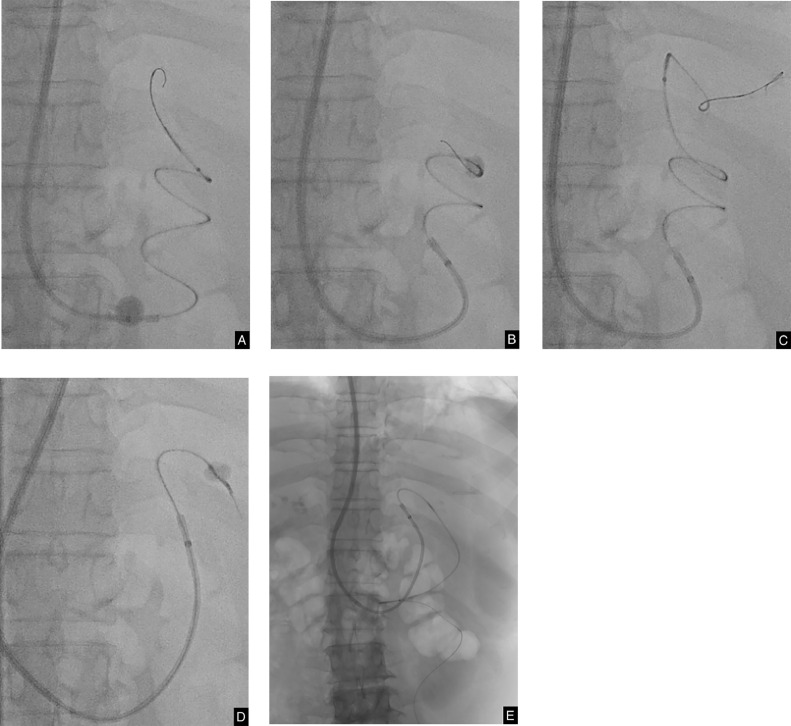 Fig 3