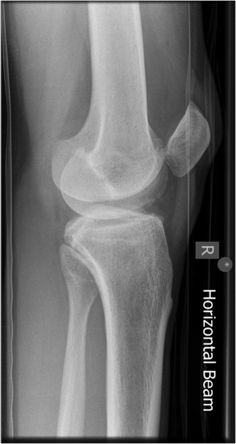 Figure 1: