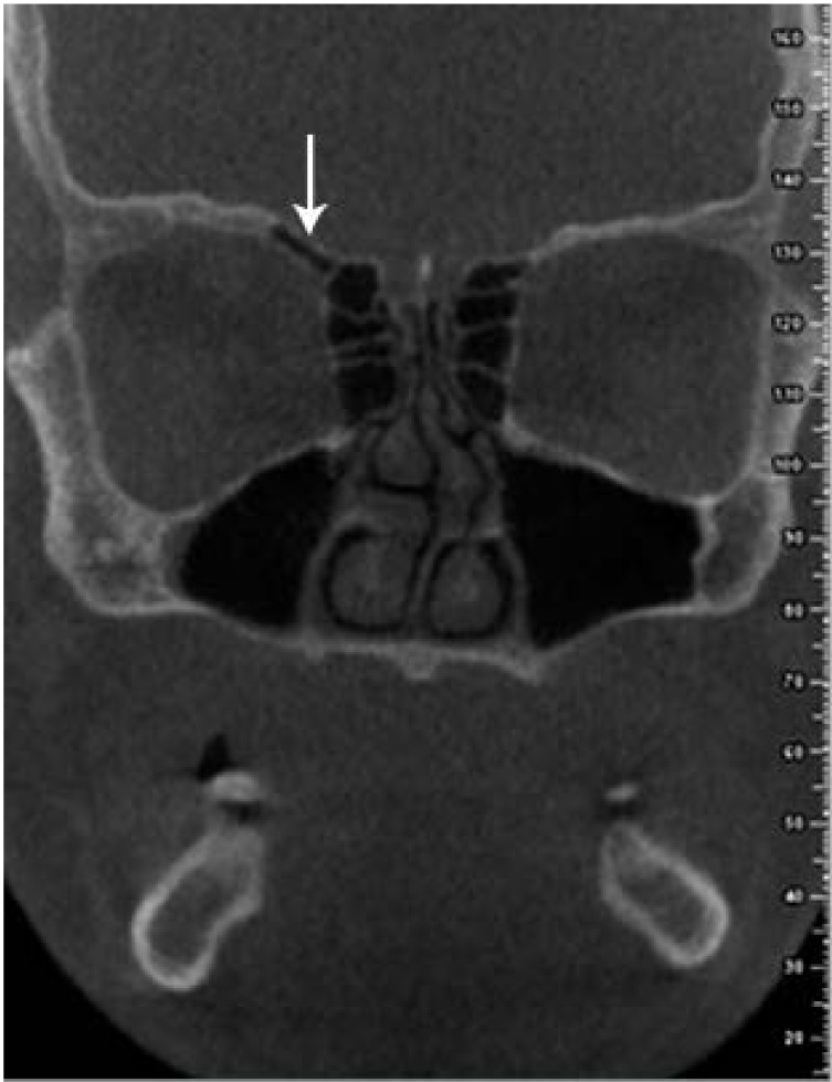 Fig. 11