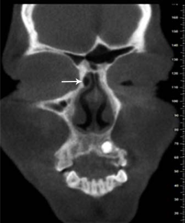 Fig. 7