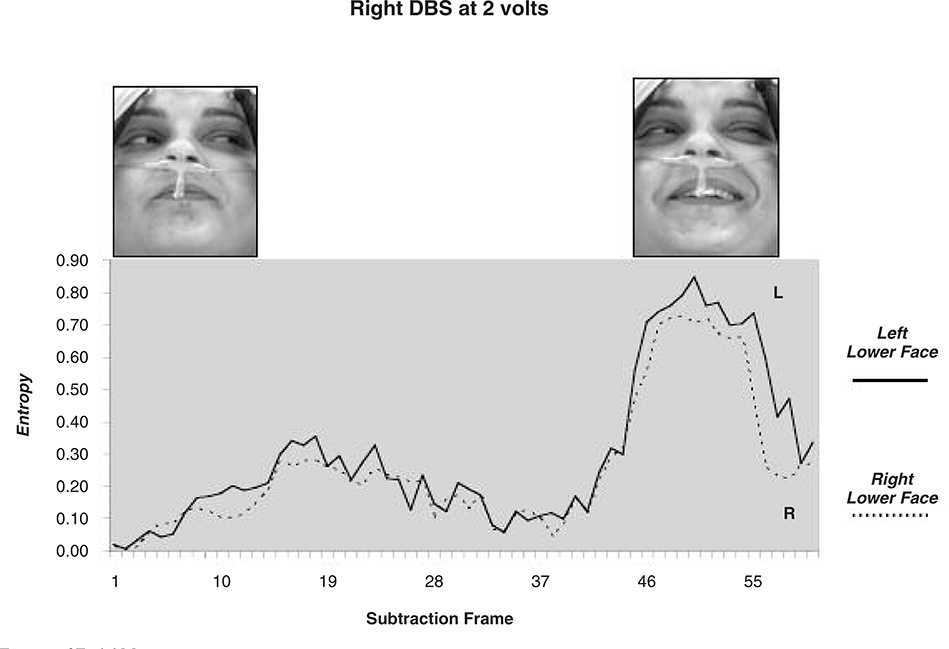 Fig. 2a.