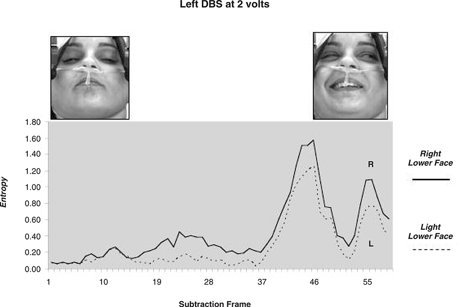 Fig. 2b.