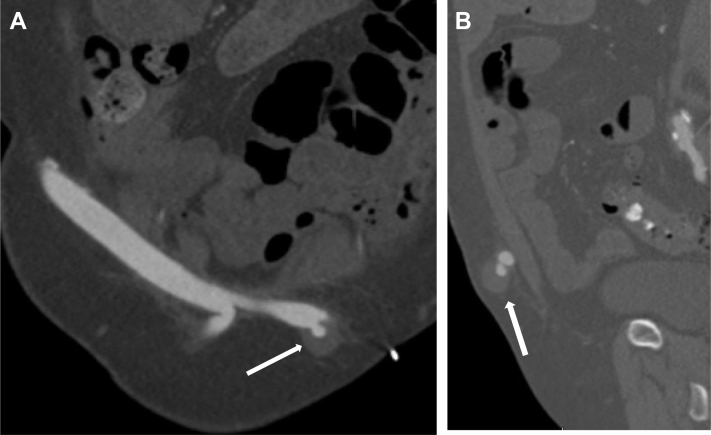 Fig 2