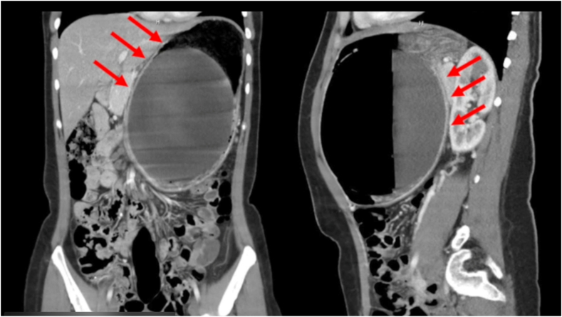 Figure 2