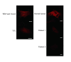 Immunostaining of human and mouse fibroblasts using anti-dysferlin