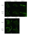 Membrane blebbing assay of human and mouse fibroblasts