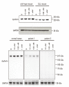 Immunoblot analysis of human and mouse fibroblasts after the treatment with proteosomal inhibitor