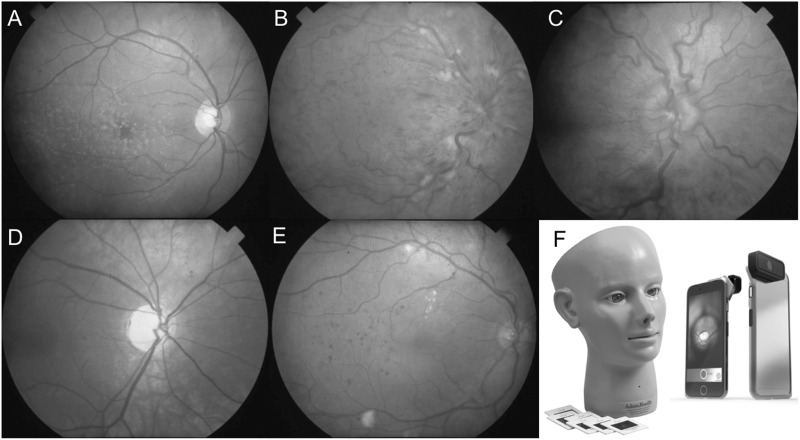 Fig. 1