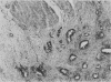 968