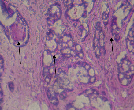 Figure 1c)