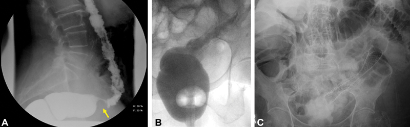 Fig. 11