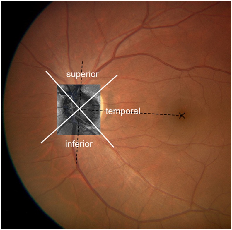 Fig 2