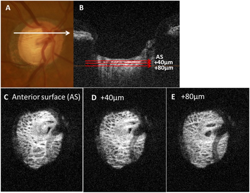 Fig 3