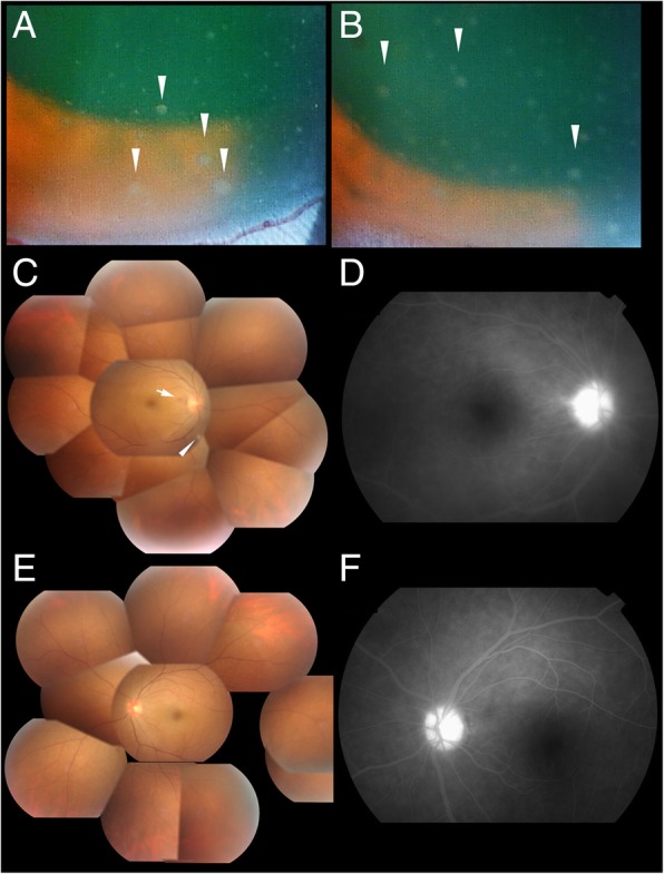 Fig. 2