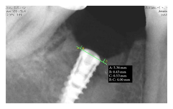 Figure 13