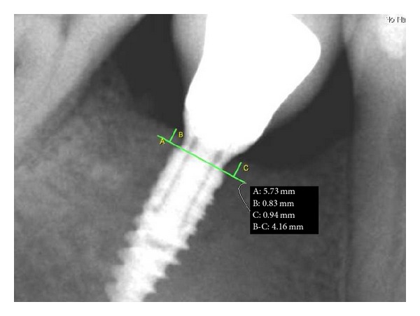 Figure 21