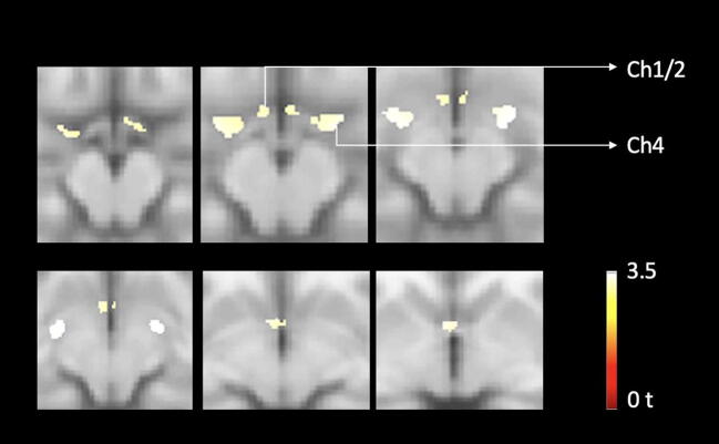 Fig. 3