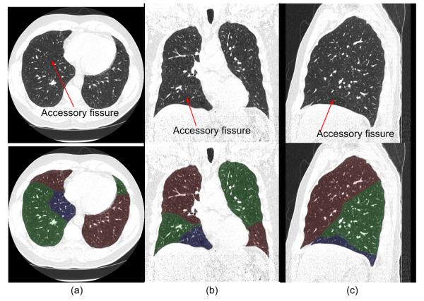 Fig. 10