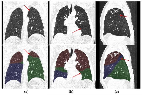 Fig. 11