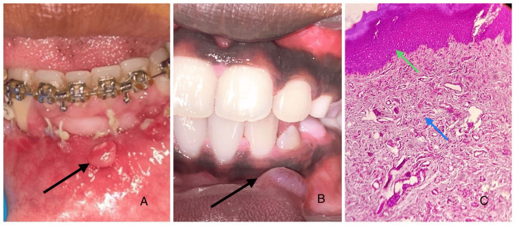 Figure 5