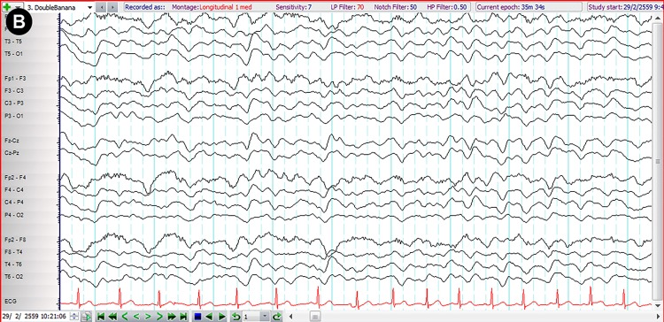 Figure 3