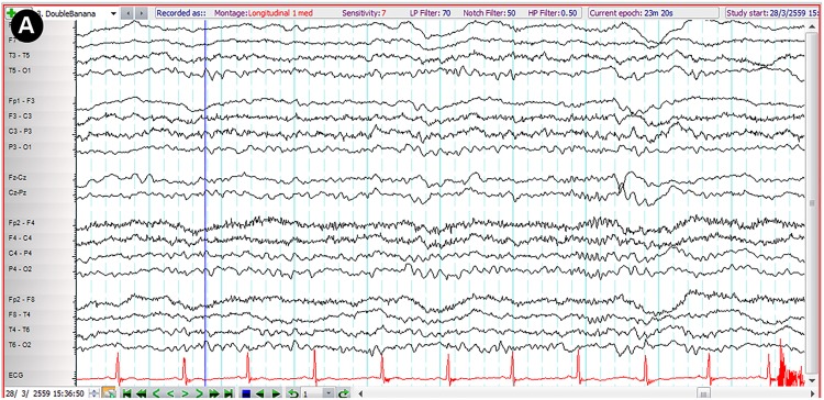 Figure 2