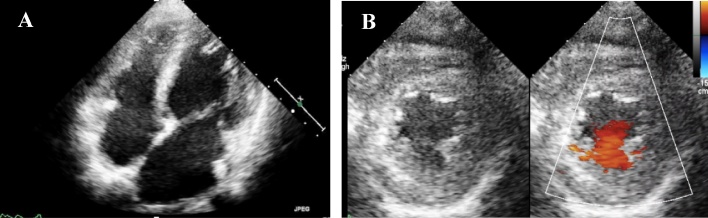 Fig. 1