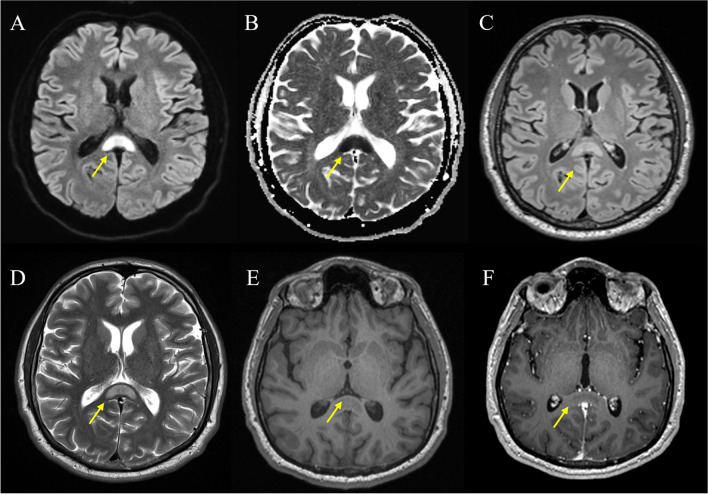 Fig. 2