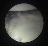 Fig 5