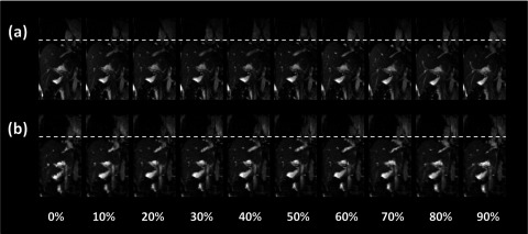 FIG. 14.